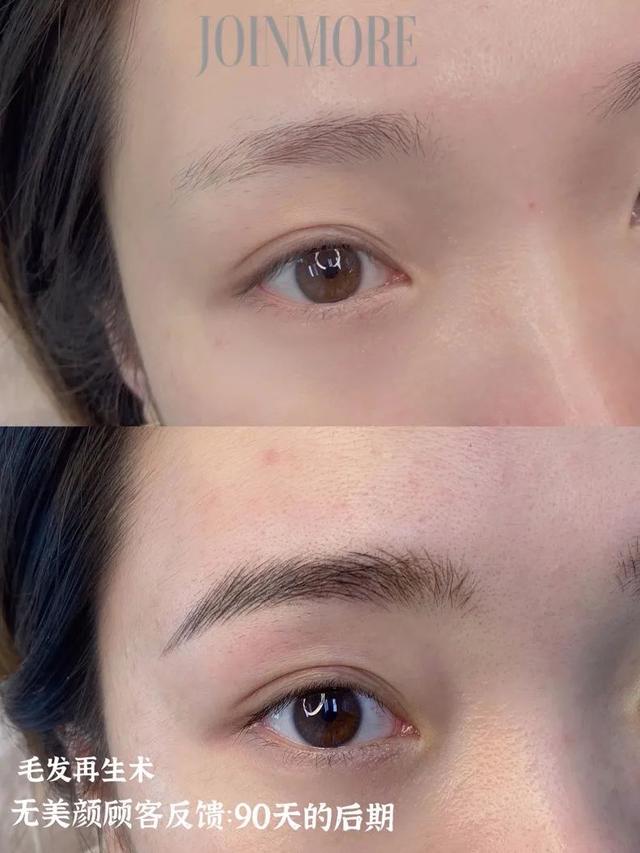 四虎免费在线观看白丝 营销词指的是什么意思（什么属于营销词）