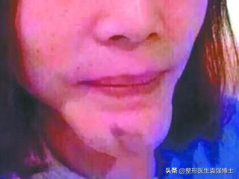 探花流出视频在线观看 医美项目名称大全，医美项目名称大全表？
